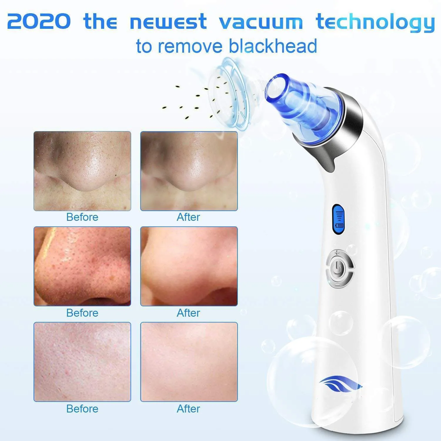 2020 Blackhead Remover Vacuum Tool